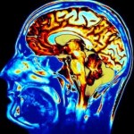 Effects of Mold On The Brain